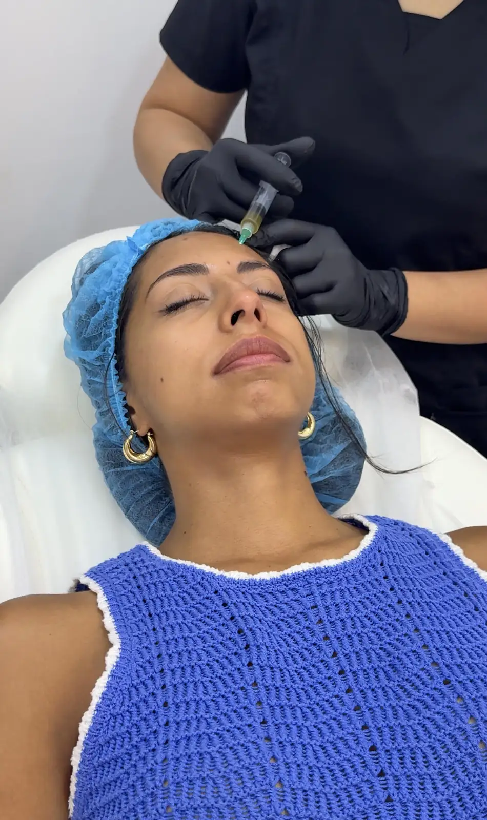 Skin Enhancing Exosomes before and after